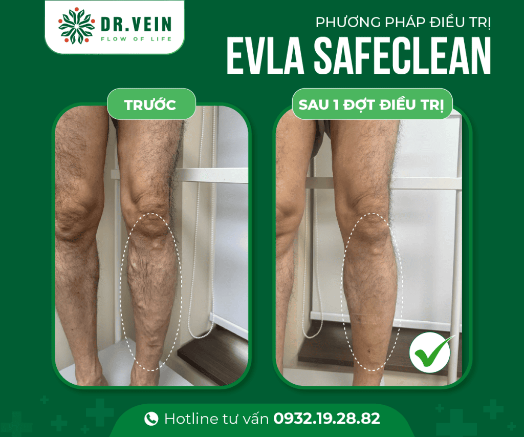 241025 EVLA SAFECLEAN 3 Web