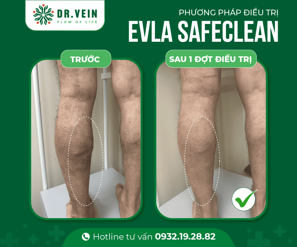241025 EVLA SAFECLEAN 4 Web