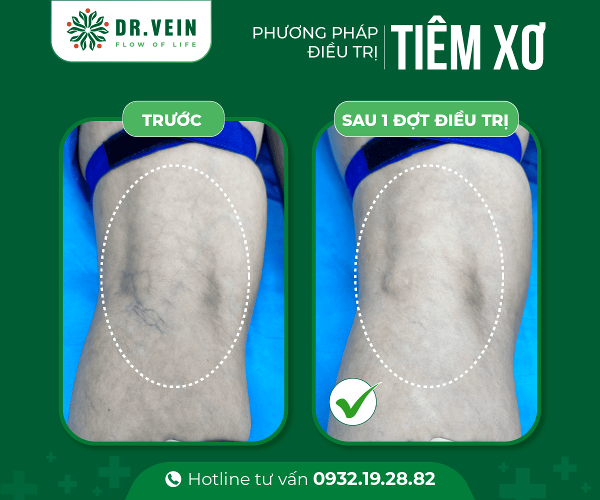 Tiem-xo-gan-xanh-01