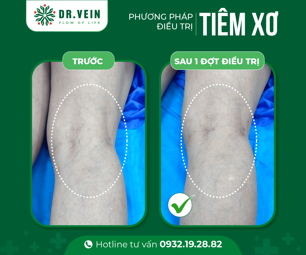 Tiem-xo-gan-xanh-02
