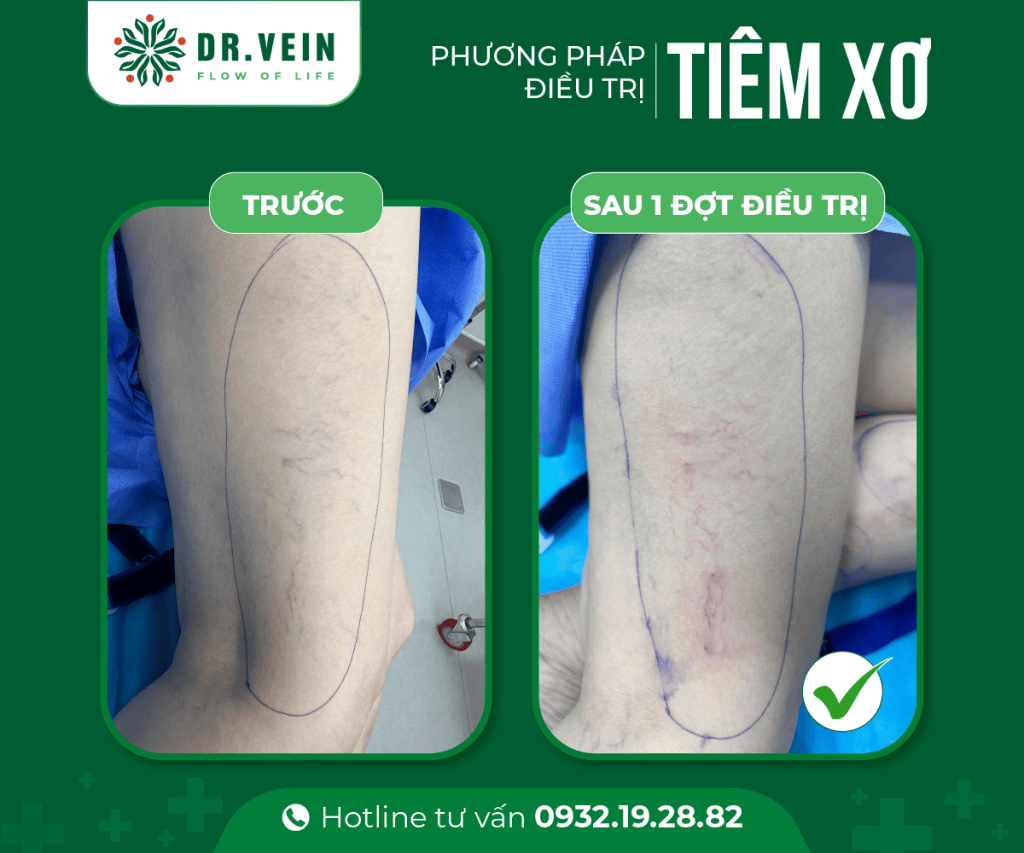 241113 Vo Thi Hong Le 1 Web