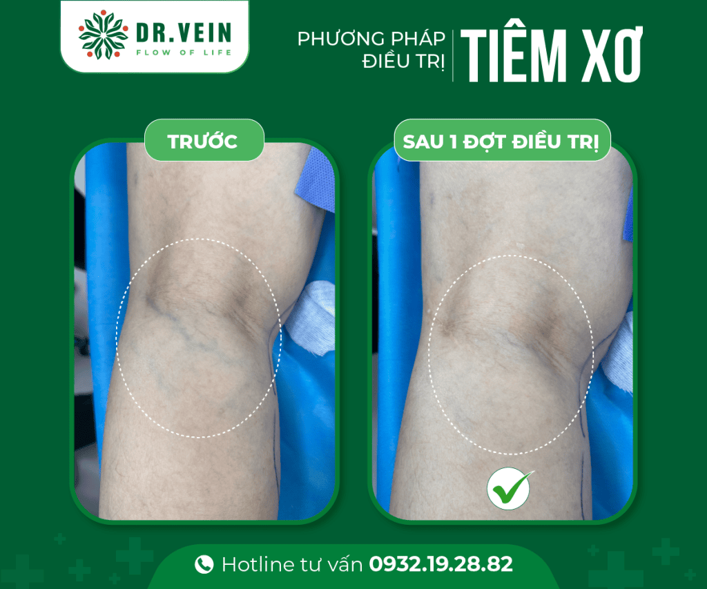 241113 Vo Thi Hong Le 2 Web