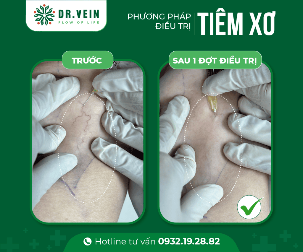 241113 Vo Thi Hong Le 3 Web
