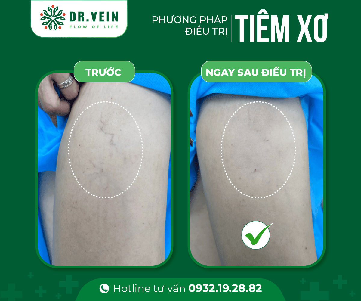 tiem-xo-04