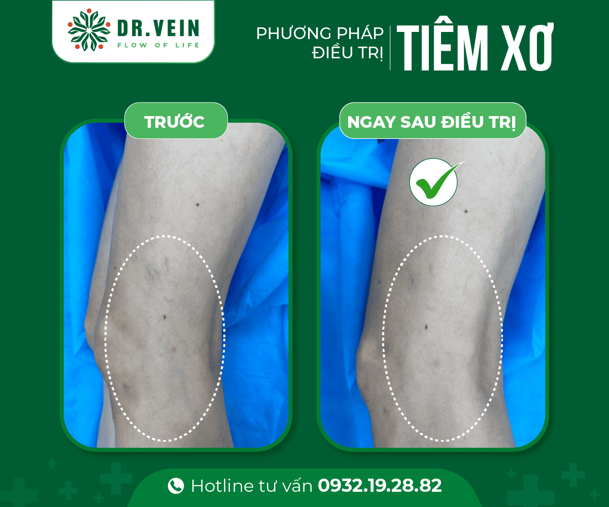 tiem-xo-03
