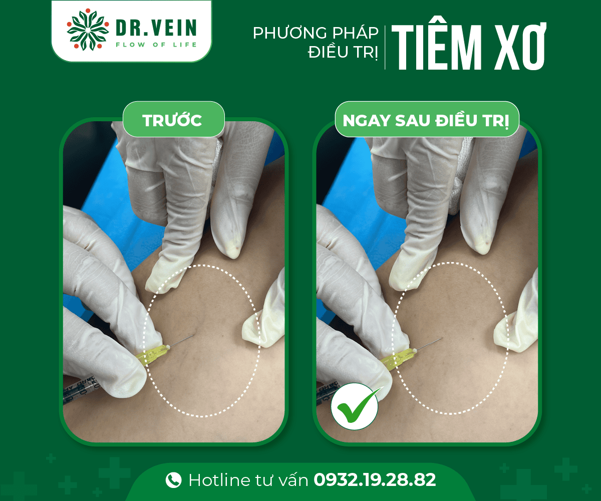 tiem-xo-01