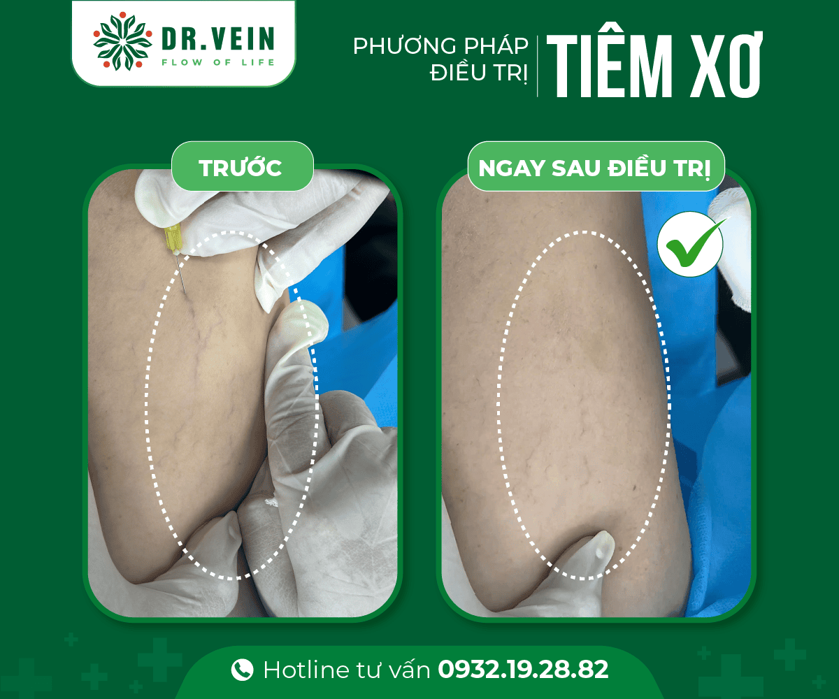 tiem-xo