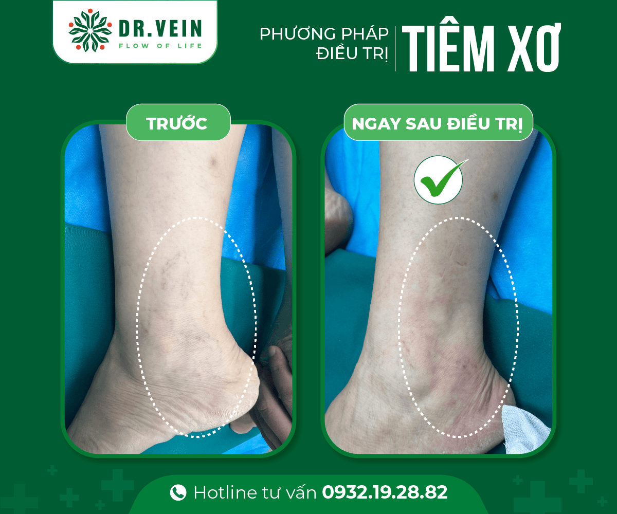 tiem-xo-03