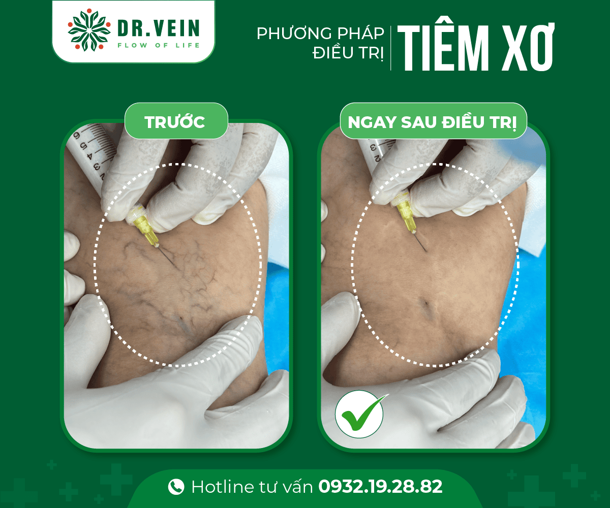 tiem-xo-01