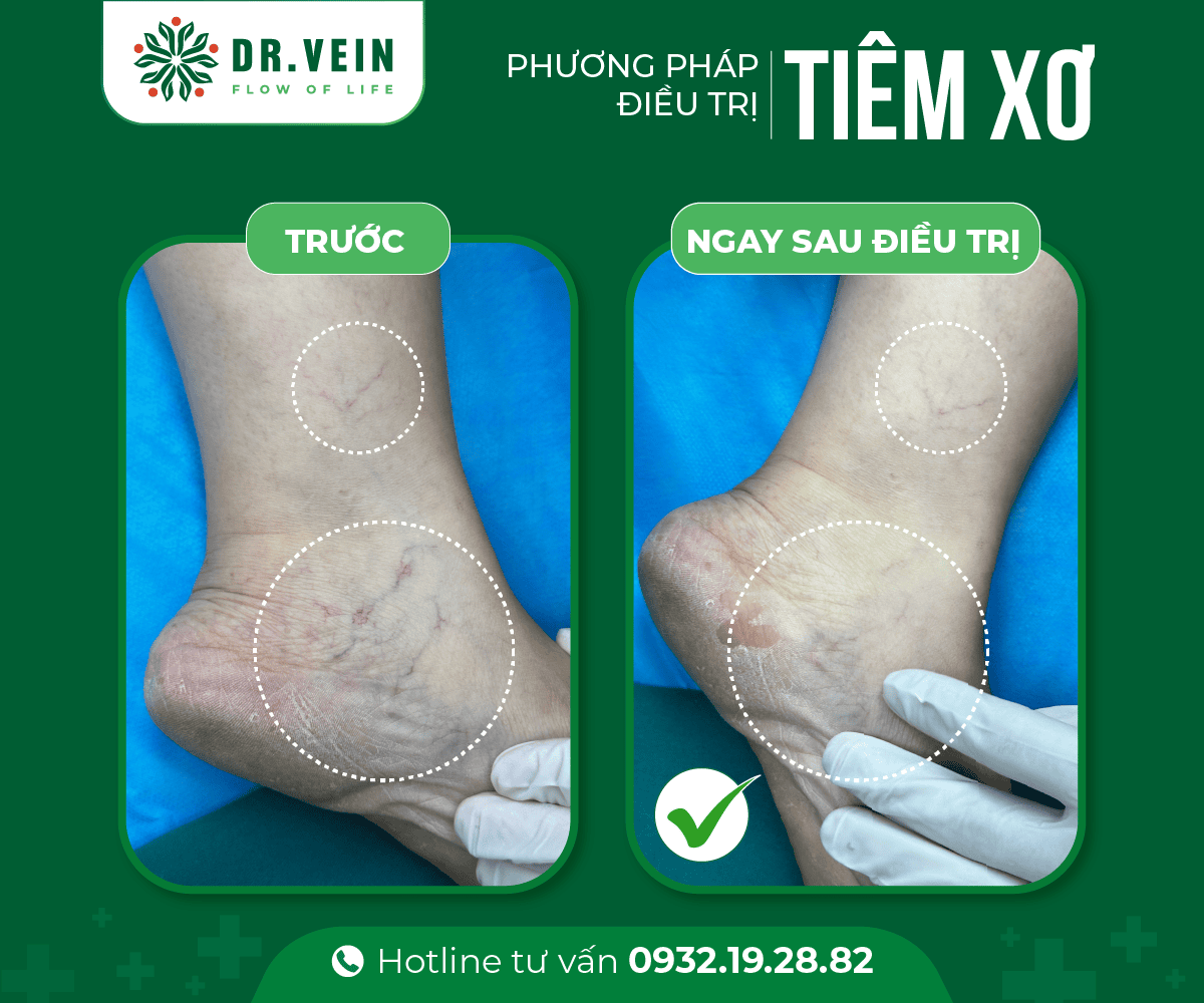 tiem-xo-02