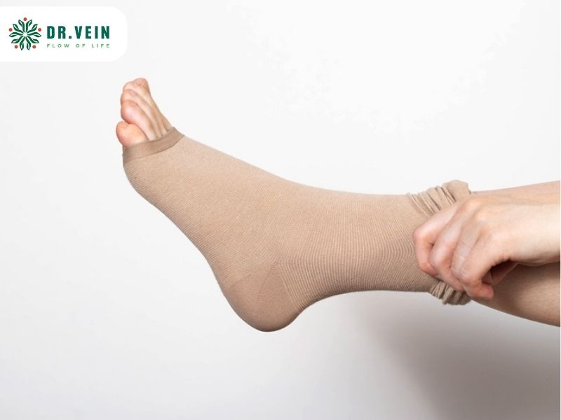 Phác đồ điều trị suy van tĩnh mạch chi dưới cho người trẻ tuổi Phác đồ điều trị suy van tĩnh mạch chi dưới cho người trẻ tuổi
