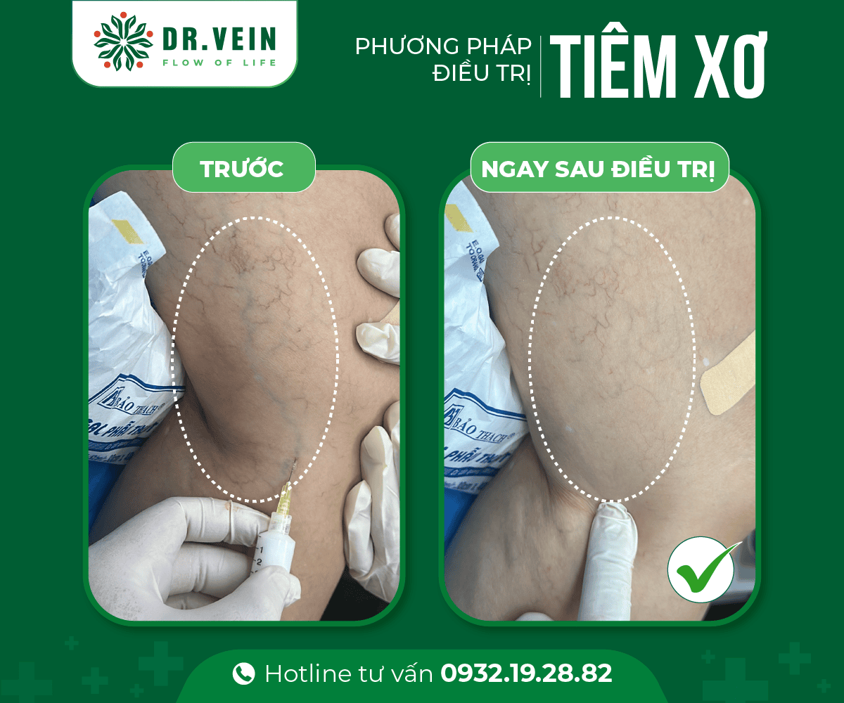 UGFS-va-tiem-xo-02