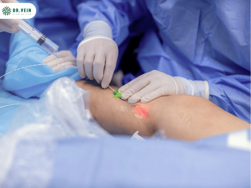 Chân nổi gân xanh có chữa được không? Hiểu đúng để điều trị từ gốc