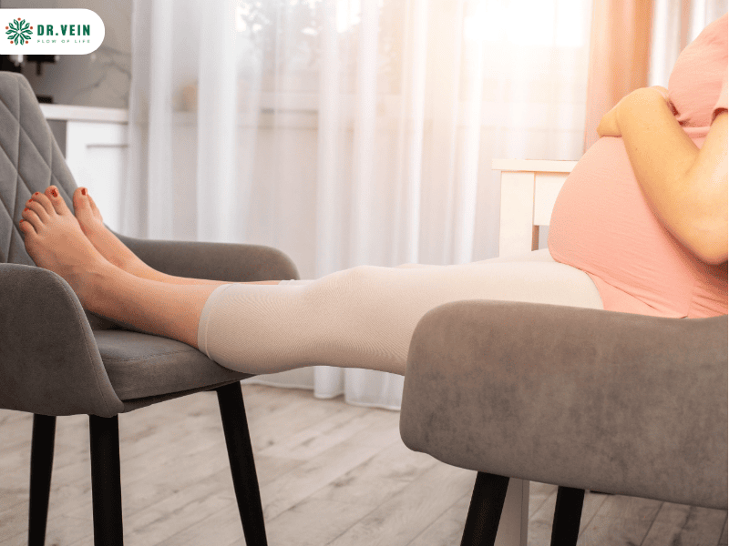 Phụ nữ sau sinh chân nổi gân xanh tím: Khi nào cần điều trị? Phụ nữ sau sinh chân nổi gân xanh tím: Khi nào cần điều trị?