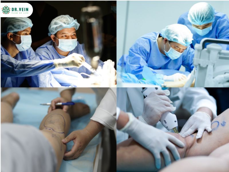 Tiêm xơ tĩnh mạch là gì? Quy trình, ưu điểm và những điều cần biết Điều trị suy giãn tĩnh mạch ở đâu?