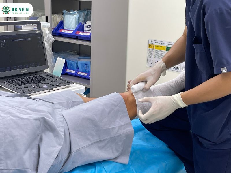 Tiêm xơ tĩnh mạch là gì? Quy trình, ưu điểm và những điều cần biết Các bước điều trị tiêm xơ tĩnh mạch