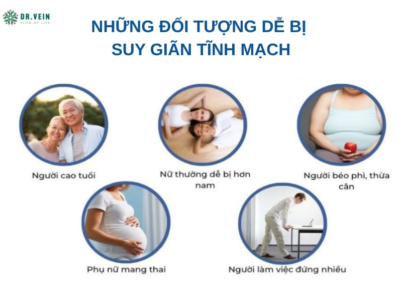 Nhóm đối tượng dễ mắc suy giãn tĩnh mạch - tiêm xơ tĩnh mạch có nguy hiểm không
