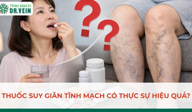 Thuốc Suy Giãn Tĩnh Mạch Có Thực Sự Hiệu Quả?