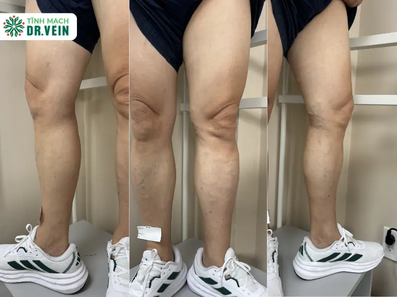 Tình Trạng Ban Đầu: Sự Chủ Động Trong Chăm Sóc Sức Khỏe