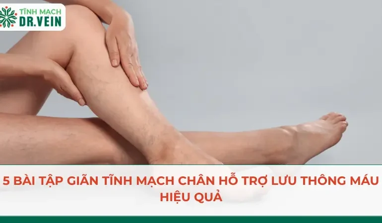 5 Bài Tập Giãn Tĩnh Mạch Chân Hỗ Trợ Lưu Thông Máu Hiệu Quả 5 Bài Tập Giãn Tĩnh Mạch Chân Hỗ Trợ Lưu Thông Máu Hiệu Quả