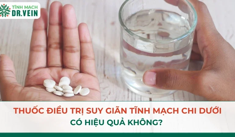 Thuốc Điều Trị Suy Giãn Tĩnh Mạch Chi Dưới: Có Hiệu Quả Không? Thuốc Điều Trị Suy Giãn Tĩnh Mạch Chi Dưới: Có Hiệu Quả Không?