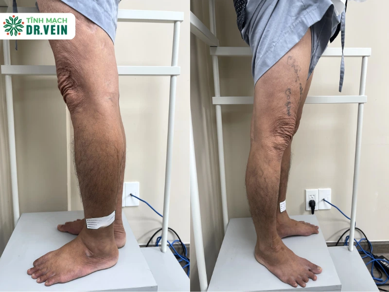 Phác Đồ Điều Trị Toàn Diện: Can Thiệp Cá Nhân Hóa