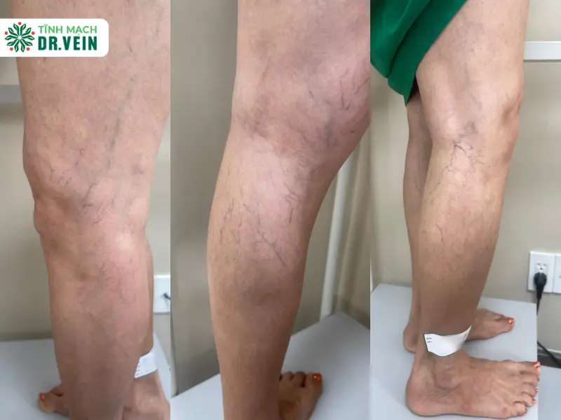 Nhìn Lại Hồ Sơ Cũ: Bệnh Lý Nặng Nề Đã Từng Được Giải Quyết Triệt Để