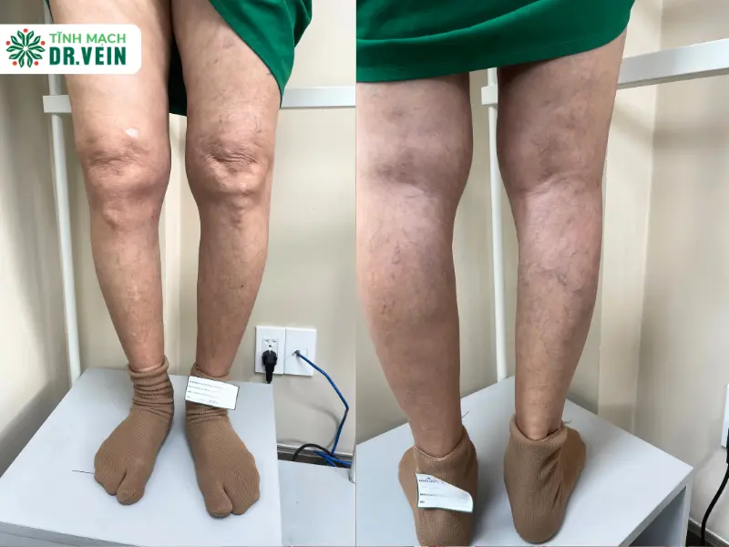 Nỗi Ám Ảnh Bất Ngờ Quay Trở Lại: Hậu Quả Từ Sự Chủ Quan