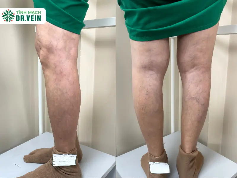 Phân Tích Căn Nguyên Gây Bệnh: Lỗi Nằm Ở Thói Quen Sinh Hoạt