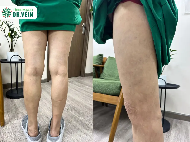 Chẩn Đoán Chuyên Sâu: Tìm Ra Nguồn Gốc Bệnh Lý Mới