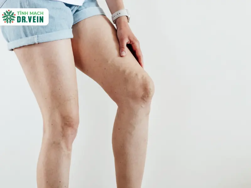 Understanding Different Modalities and Their Impact on Fitness