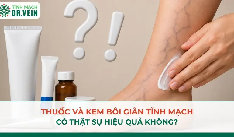 Thuốc và kem bôi giãn tĩnh mạch có thật sự hiệu quả không? Thuốc và kem bôi giãn tĩnh mạch có thật sự hiệu quả không?