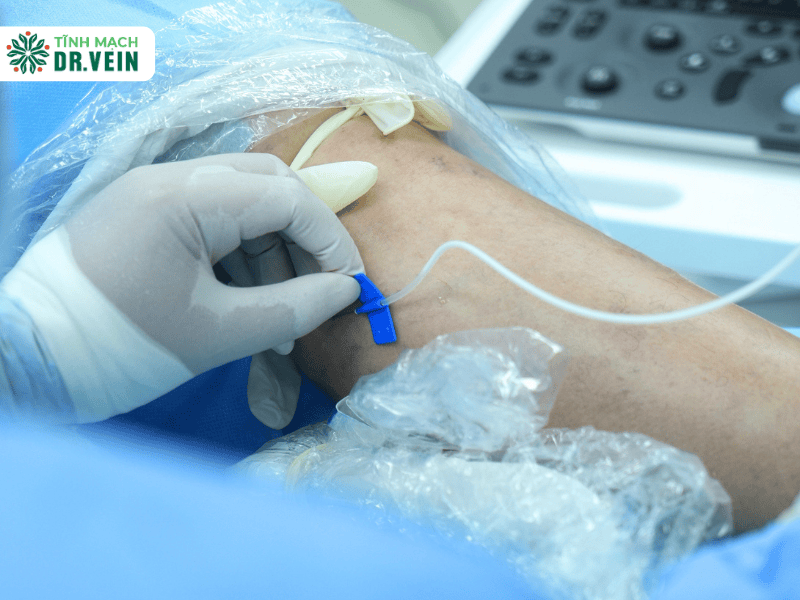 What Should You Expect After UGFS?