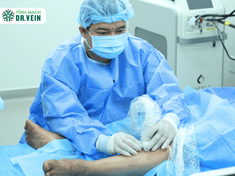 UGFS Success Rate for Recurrent Varicose Veins