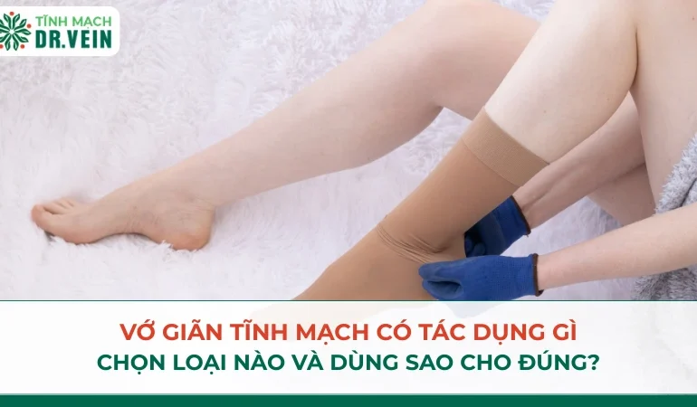 Vớ giãn tĩnh mạch có tác dụng gì, chọn loại nào và dùng sao cho đúng? Vớ giãn tĩnh mạch có tác dụng gì, chọn loại nào và dùng sao cho đúng?
