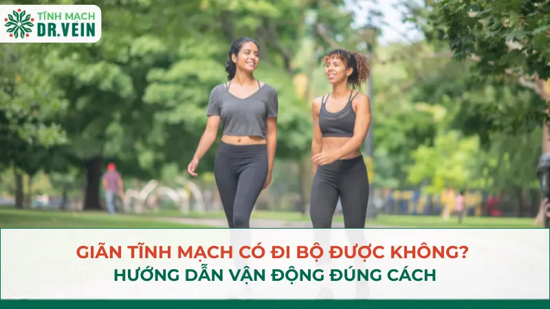 Giãn tĩnh mạch có đi bộ được không? Hướng dẫn vận động đúng cách