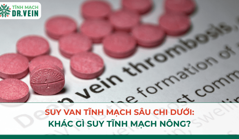 Suy van tĩnh mạch sâu chi dưới: khác gì suy tĩnh mạch nông?