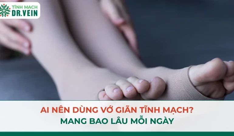 Ai nên dùng vớ giãn tĩnh mạch, mang bao lâu mỗi ngày, bao nhiêu tháng và khi nào được ngừng?