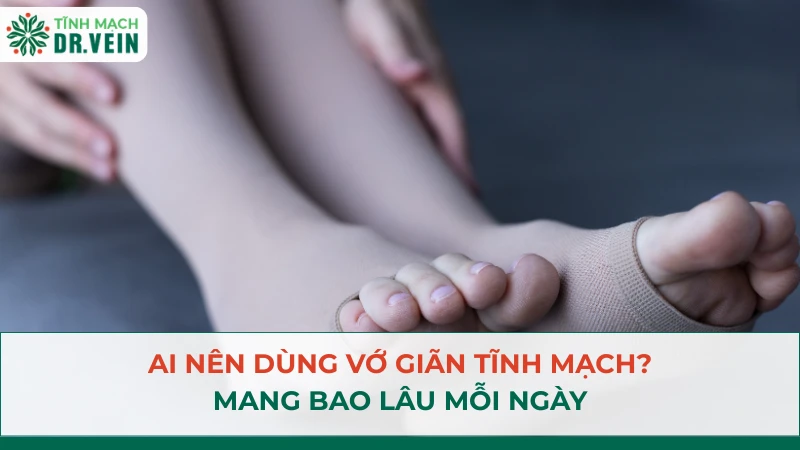 Ai nên dùng vớ giãn tĩnh mạch, mang bao lâu mỗi ngày, bao nhiêu tháng và khi nào được ngừng?