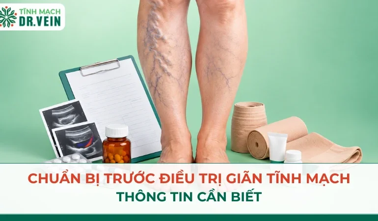 Chuẩn bị trước điều trị giãn tĩnh mạch: thông tin cần biết Chuẩn bị trước điều trị giãn tĩnh mạch: thông tin cần biết