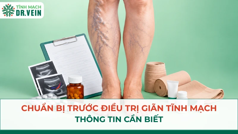 Chuẩn bị trước điều trị giãn tĩnh mạch: thông tin cần biết Chuẩn bị trước điều trị giãn tĩnh mạch: thông tin cần biết